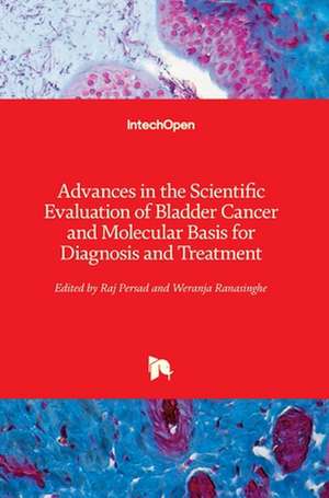 Advances in the Scientific Evaluation of Bladder Cancer and Molecular Basis for Diagnosis and Treatment de Raj Persad