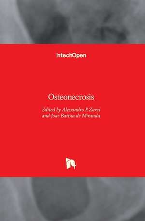 Osteonecrosis de Alessandro Rozim Zorzi