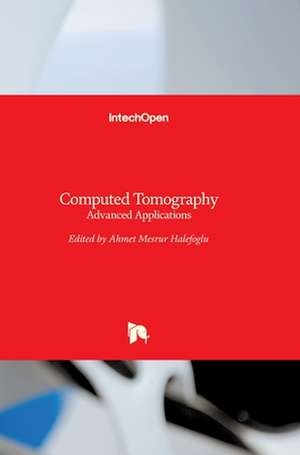 Computed Tomography de Ahmet Mesrur Halefo¿lu