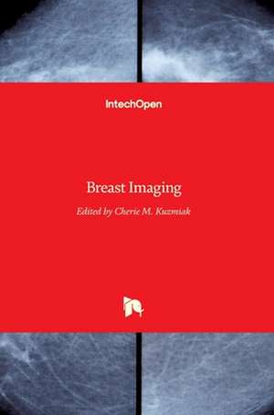 Breast Imaging de Cherie M. Kuzmiak