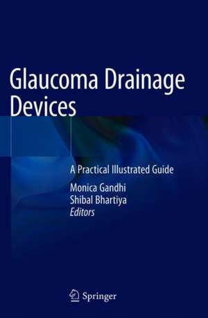 Glaucoma Drainage Devices: A Practical Illustrated Guide de Monica Gandhi