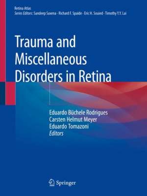 Trauma and Miscellaneous Disorders in Retina de Eduardo Büchele Rodrigues