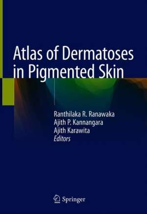 Atlas of Dermatoses in Pigmented Skin de Ranthilaka R. Ranawaka