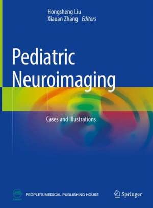Pediatric Neuroimaging: Cases and Illustrations de Hongsheng Liu