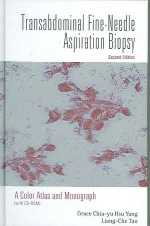 Transabdominal Fine-Needle Aspiration Biopsy: A Color Atlas And Monograph de M.D. Yang, Grace Chia-yu