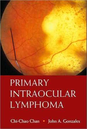 Primary Intraocular Lymphoma de Chi-Chao Chan