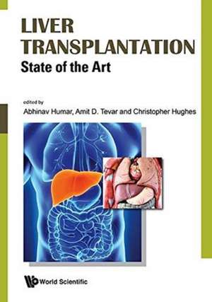 LIVER TRANSPLANTATION de Amit Tevar & Christopher Abhinav Humar