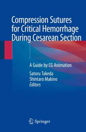 Compression Sutures for Critical Hemorrhage During Cesarean Section: A Guide by CG Animation de Satoru Takeda