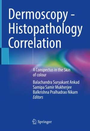 Dermoscopy - Histopathology Correlation : A Conspectus in the Skin of colour de Balachandra Suryakant Ankad