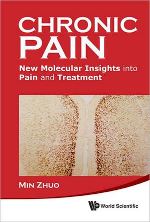 Chronic Pain: New Molecular Insights Into Pain and Treatment de Min Zhuo