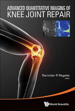 Advanced Quantitative Imaging of Knee Joint Repair: For O&G Clinicians and General Practitioners de RAVINDER R REGATTE