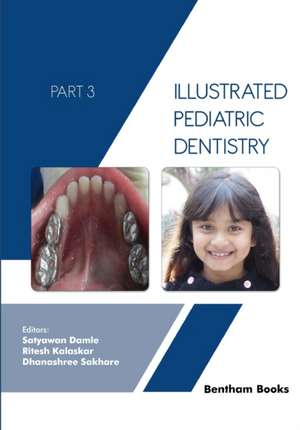 Illustrated Pediatric Dentistry - Part 3 de Satyawan Damle