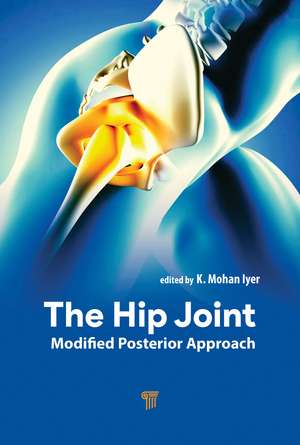 The Hip Joint: Modified Posterior Approach de K. Mohan Iyer