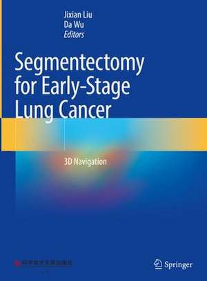 Segmentectomy for Early-Stage Lung Cancer: 3D Navigation de Jixian Liu