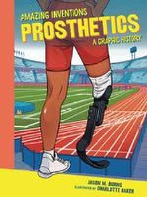 Burns, J: Prosthetics