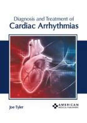 Diagnosis and Treatment of Cardiac Arrhythmias de Joe Tyler