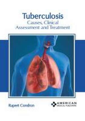 Tuberculosis: Causes, Clinical Assessment and Treatment de Rupert Condron