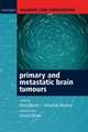 Palliative Care Consultations in Primary and Metastatic Brain Tumours