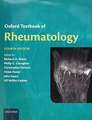 Oxford Textbook of Rheumatology