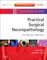 Practical Surgical Neuropathology: A Diagnostic Approach: A Volume in the Pattern Recognition Series, Expert Consult: Online and Print