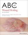 ABC of Wound Healing 2nd Edition