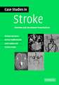 Case Studies in Stroke: Common and Uncommon Presentations