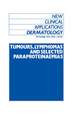 Tumours, Lymphomas and Selected Paraproteinaemias