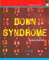 Down Syndrome