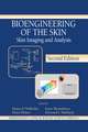 Bioengineering of the Skin: Skin Imaging & Analysis