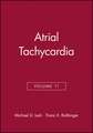 Atrial Tachycardia