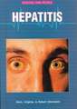 Hepatitis