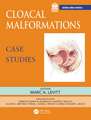 Cloacal Malformations: Case Studies