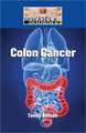 Colon Cancer