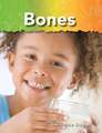 Bones: The Human Body