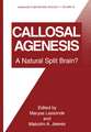 Callosal Agenesis: A Natural Split Brain?