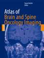 Atlas of Brain and Spine Oncology Imaging