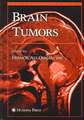 Brain Tumors