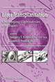 Liver Transplantation: Challenging Controversies and Topics