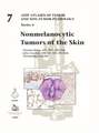 NONMELANOCYTIC TUMORS OF THE SKIN 5F07