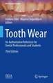 Tooth Wear : An Authoritative Reference for Dental Professionals and Students