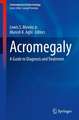 Acromegaly: A Guide to Diagnosis and Treatment