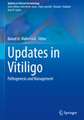 Updates in Vitiligo