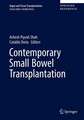 Contemporary Pancreas and Small Bowel Transplantation 