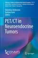 PET/CT in Neuroendocrine Tumors