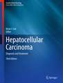 Hepatocellular Carcinoma: Diagnosis and Treatment