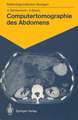 Computertomographie des Abdomens: 85 diagnostische Übungen für Studenten und praktische Radiologen