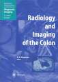 Radiology and Imaging of the Colon