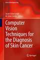 Computer Vision Techniques for the Diagnosis of Skin Cancer