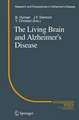 The Living Brain and Alzheimer’s Disease