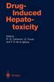 Drug-Induced Hepatotoxicity